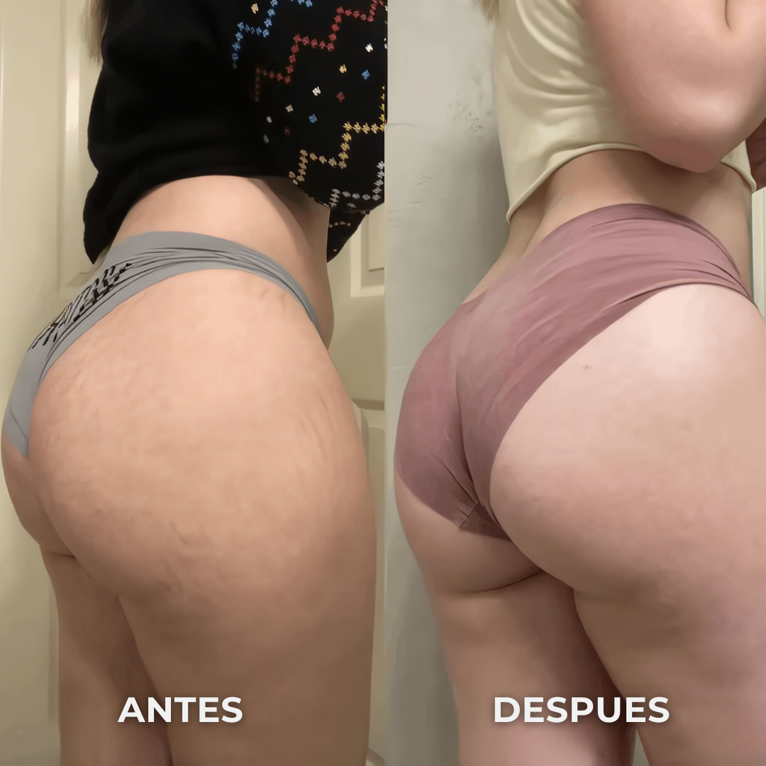 FitSculpt® PRO - Estimulador de Glúteos y Abdomen