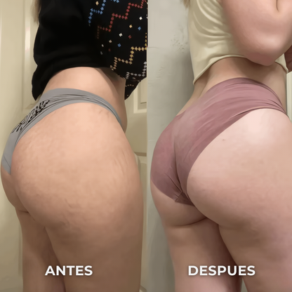 FitSculpt® PRO - Estimulador de Glúteos y Abdomen