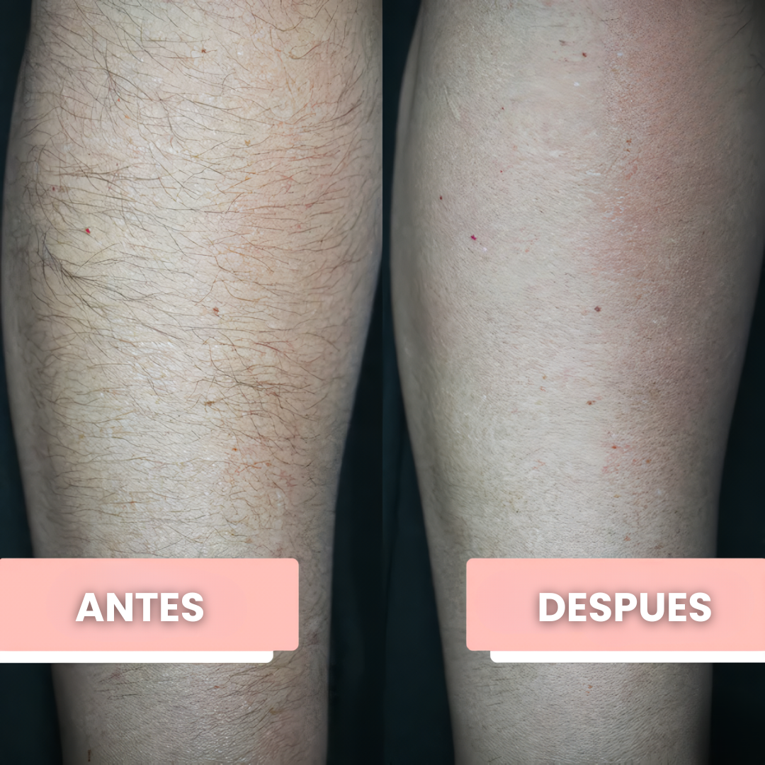 Borrador de Vello PureLisse®