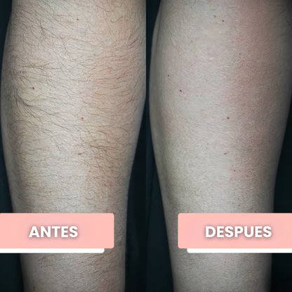 Borrador de Vello PureLisse®