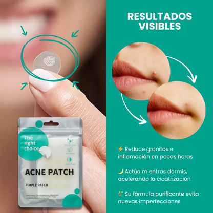 DermaClear™ Parches Anti-Acne