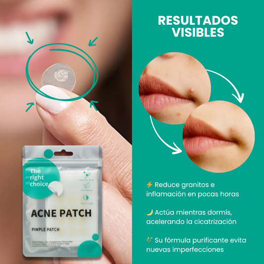 DermaClear™ Parches Anti-Acne