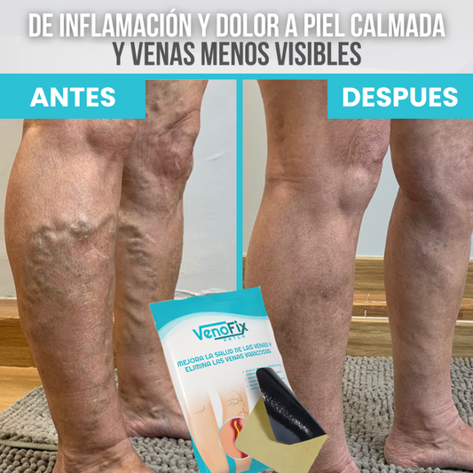 Venoflix® - Parches Naturales para Varices