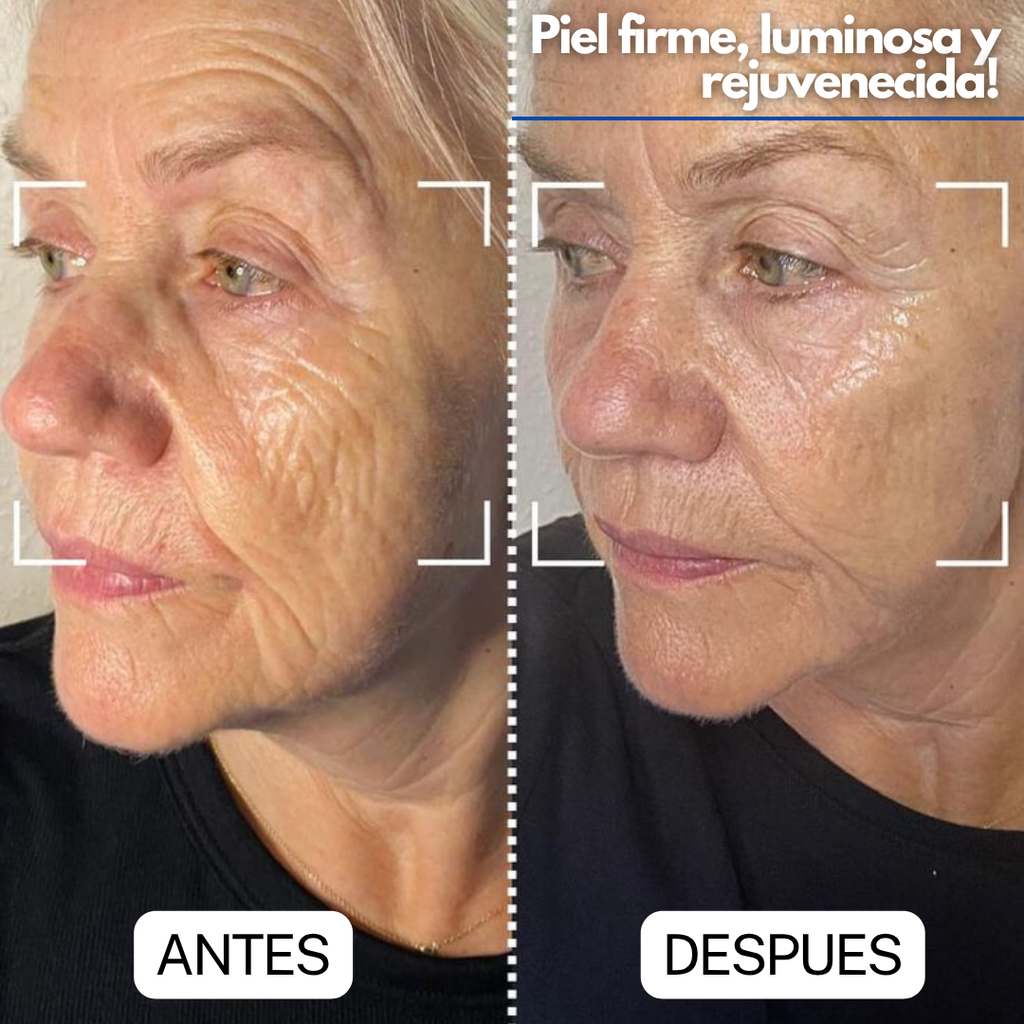 Masajeador Facial GlowSonic® + (regalo sorpresa)