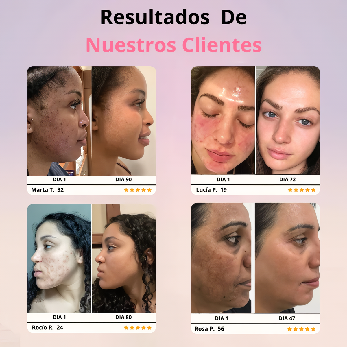 Rejuvenecedor SkinGlow® + Gel Conductor