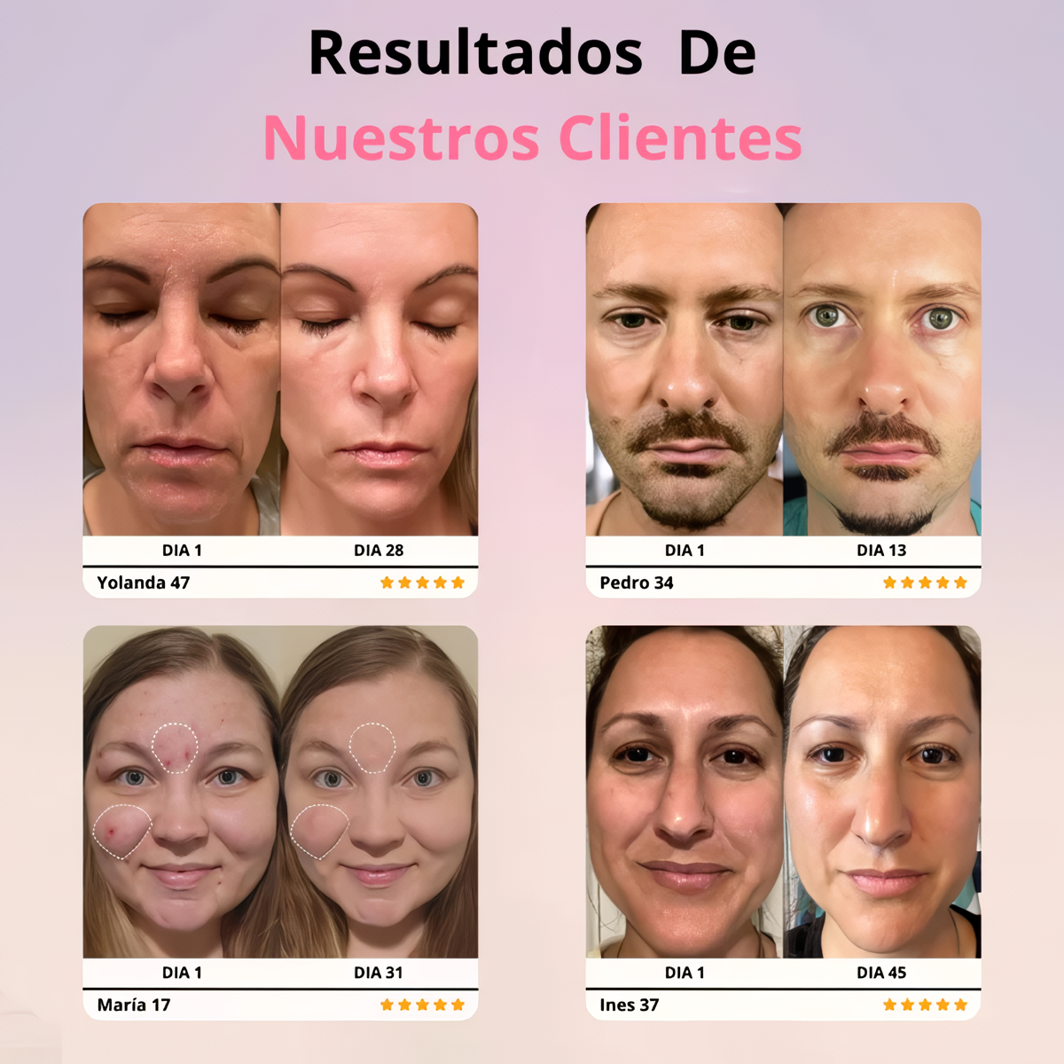 Rejuvenecedor SkinGlow® + Gel Conductor