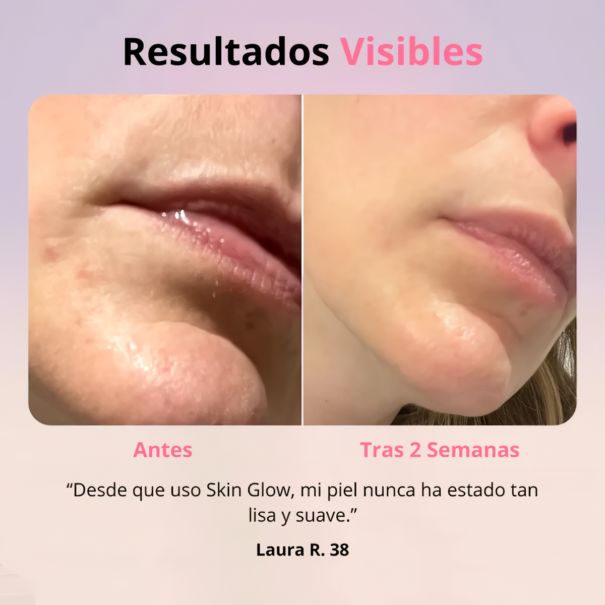 Rejuvenecedor SkinGlow® + Gel Conductor