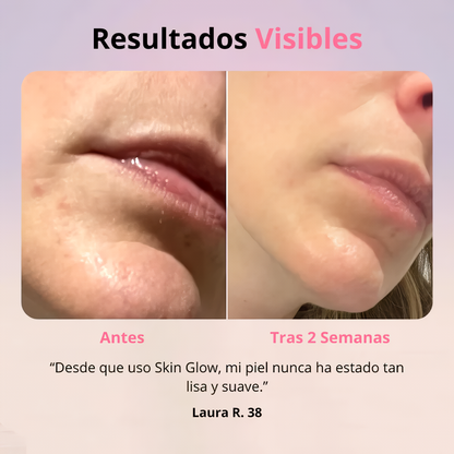 Rejuvenecedor SkinGlow® + Gel Conductor
